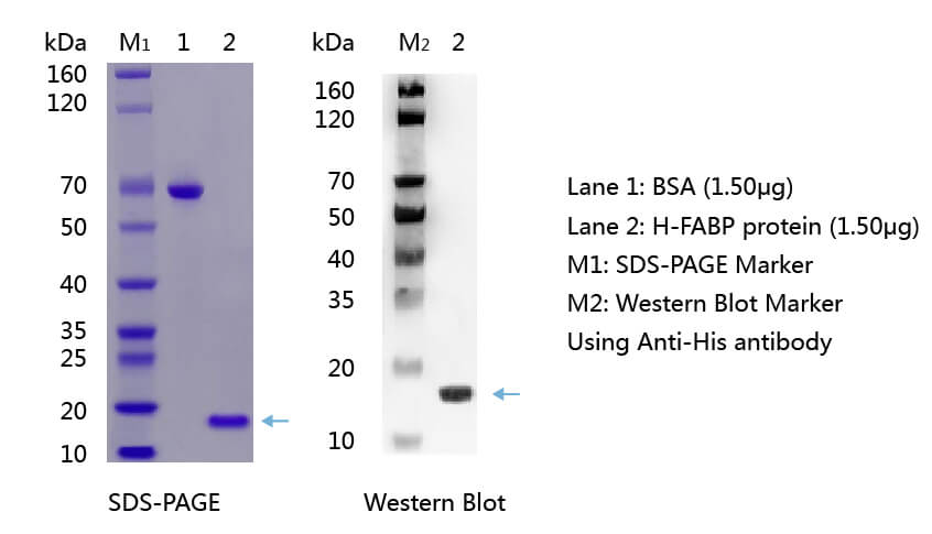 H-FABP抗原的SDS-PAGE和WB分析圖 H-FABP抗原的SDS-PAGE和WB分析圖