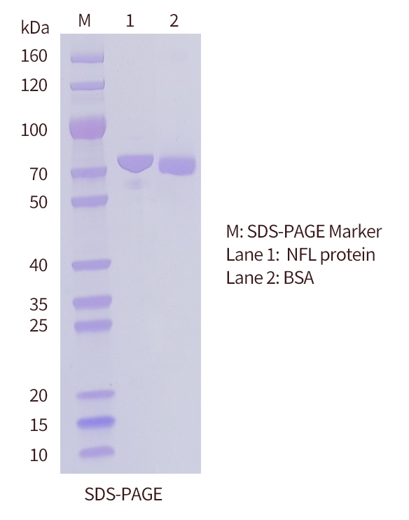 SDS-PAGE of NFL protein SDS-PAGE of NFL protein-OkayBio