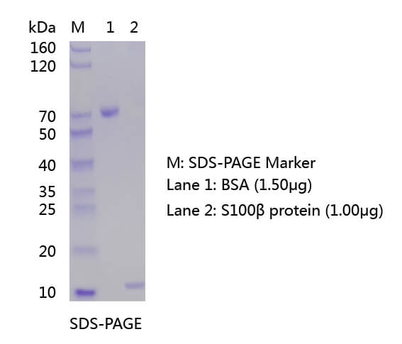 S100β蛋白的SDS-PAGE和WB分析圖 歐凱生物S100β蛋白的SDS-PAGE和WB分析圖